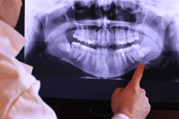 Best Tooth Infection Emergency Dentist  in Houghton Lake, MI