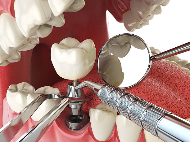 Best Broken Tooth Emergency  in Houghton Lake, MI